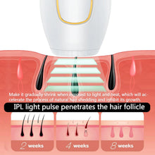 Cargar imagen en el visor de la galería, Resultados garantizados con tecnología láser IPL
